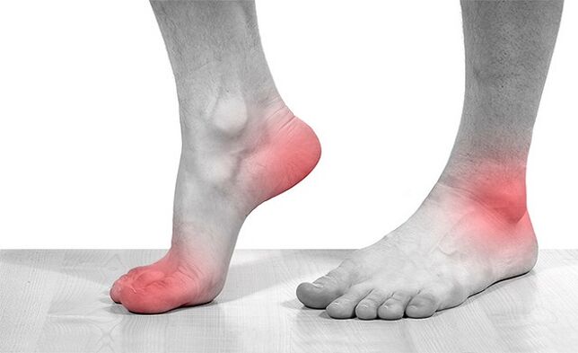 dhimbje në nyjet e kyçit të këmbës me artrozë